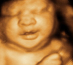3d and 4d ultrasound pictures baby face